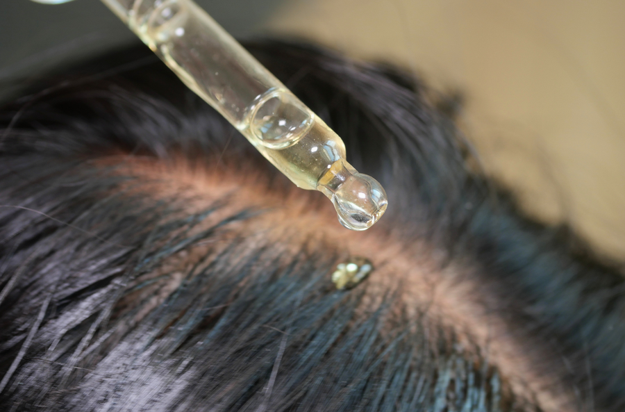 Tried oils & serums?
